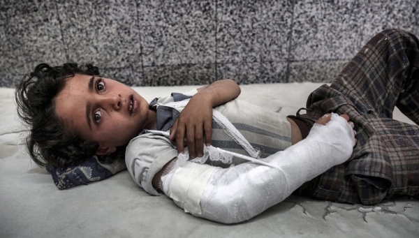 포탄에 부상당한 남예멘 아이(자료:cnn)