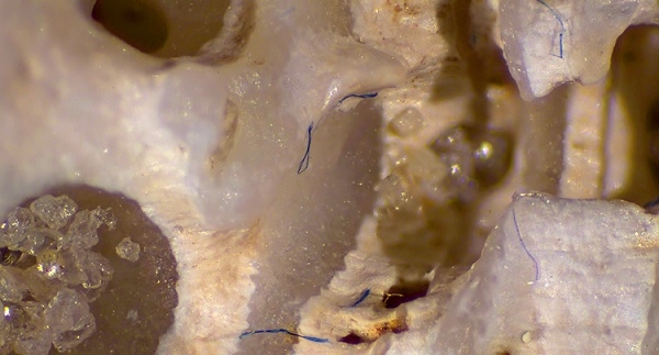 생굴의 조직에 깊이 박힌 미세 플라스틱 섬유들(자료:NGO, waterpros)