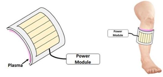 유연저극 기반 광-플라즈마 시스템을 활용한 치료 개념도. 사진=경기도 제공